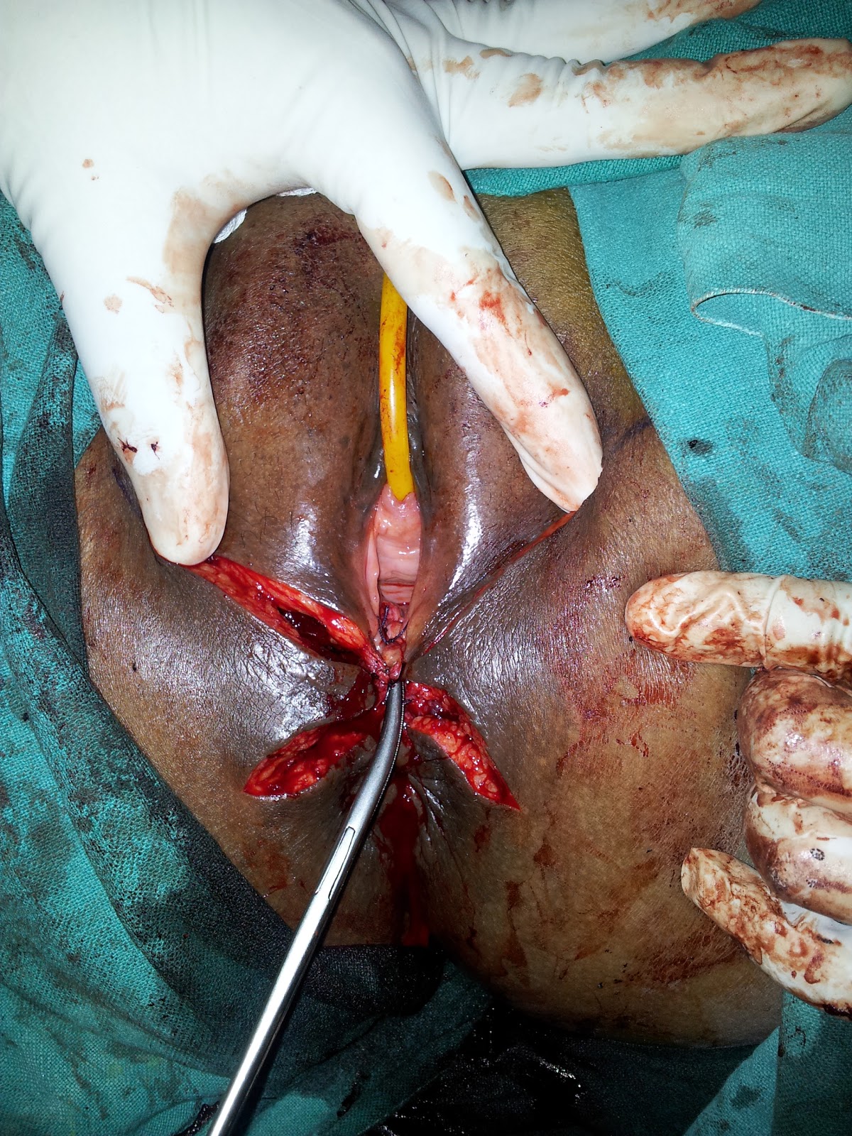 Remarkable, useful vulva and perineum opinion you You were vulva and perineum remarkable, the